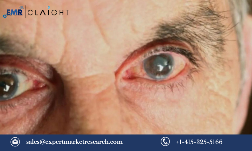 Diabetic Macular Edema Market