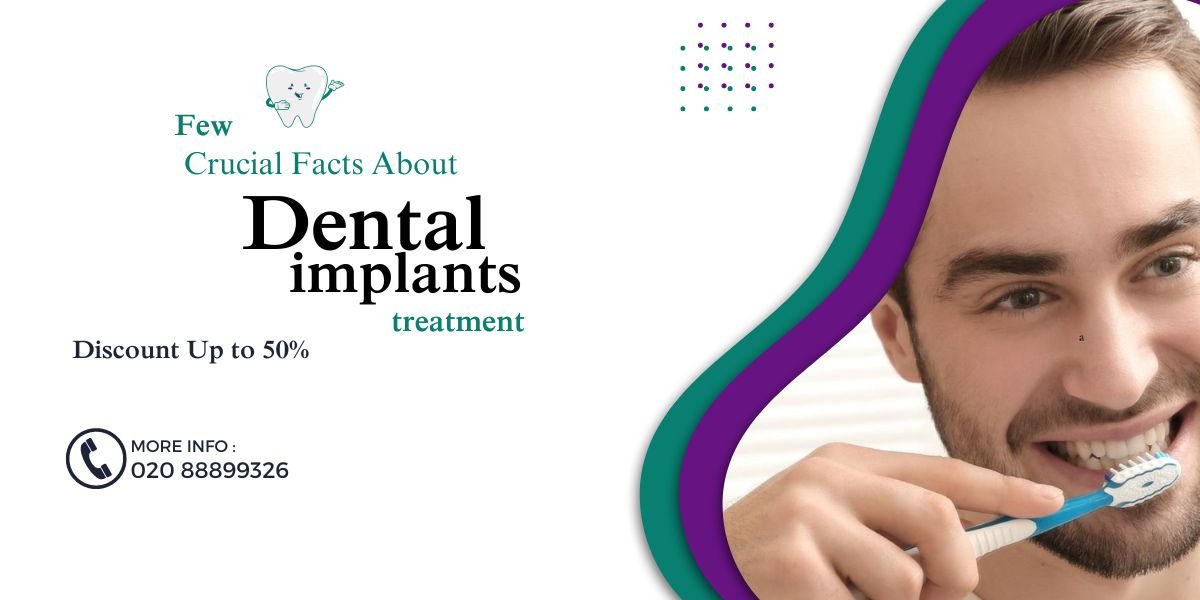 Few Crucial Facts About Dental implants treatment