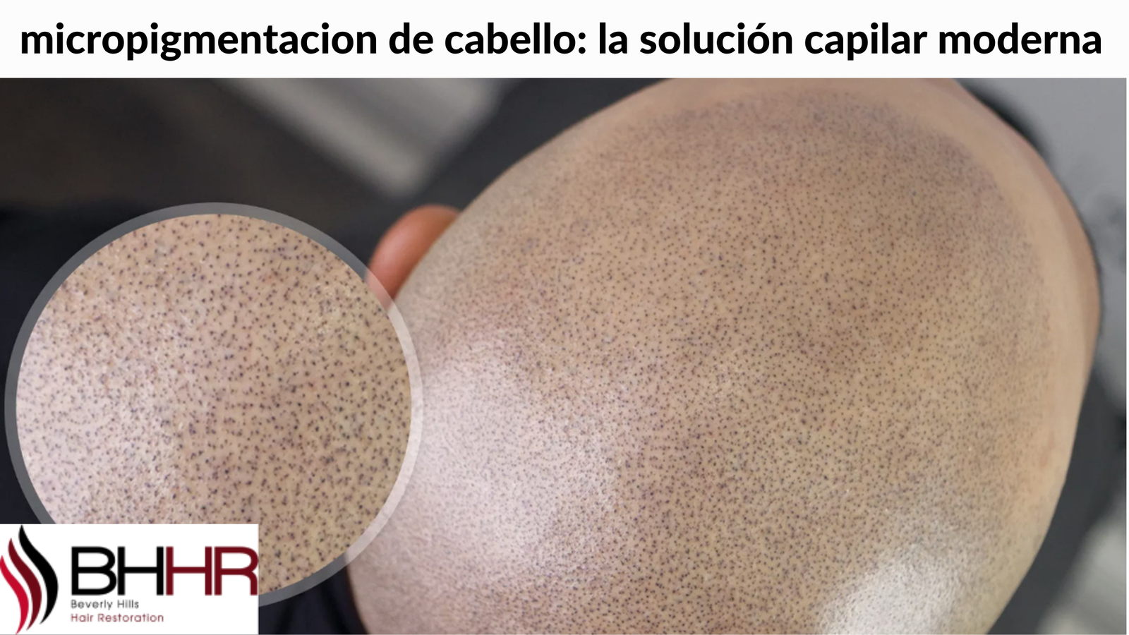 micropigmentacion de cabello